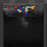 УЗИ-сканер ArtUs: результаты исследования (снимок 10)