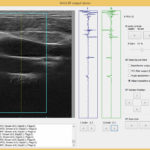 УЗИ-сканер ArtUs: результаты исследования (снимок 12)