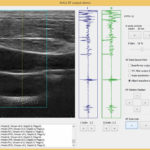 УЗИ-сканер ArtUs: результаты исследования (снимок 13)