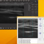УЗИ-сканер ArtUs: результаты исследования (снимок 14)