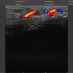 УЗИ-сканер ArtUs: результаты исследования (снимок 4)
