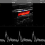 УЗИ-сканер ClarUs: результаты исследования (снимок 9)