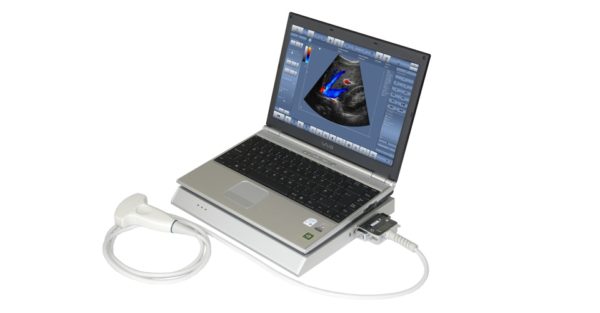 Ветеринарный УЗИ сканер LS60 - вид с ноутбуком и преобразователем